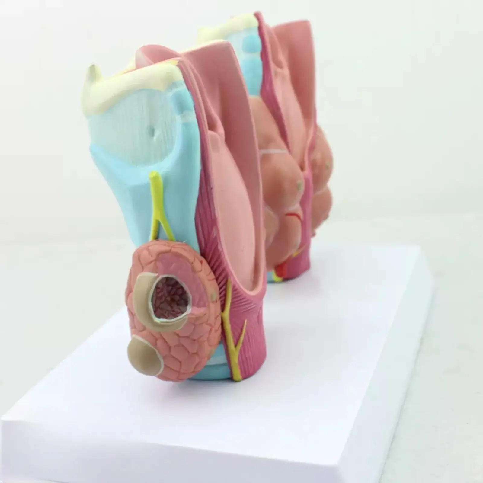 Патология на щитовидната жлеза човек Тумор в Модел на рак на щитовидната жлеза Медицинска школа Изображение 2
