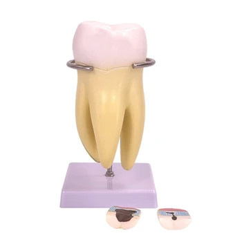 Модел на човешки зъба, анатомическая модел местни зъби, модел зъби, за да инсталирате в клиниката и комуникация на лекаря с пациента